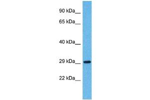 Western Blotting (WB) image for anti-Olfactory Receptor, Family 5, Subfamily H, Member 14 (OR5H14) (C-Term) antibody (ABIN2791756) (OR5H14 anticorps  (C-Term))