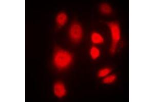 Immunofluorescent analysis of SGK1/2 (pT256/253) staining in HeLa cells. (SGK1/2 (pSer253), (pSer256) anticorps)