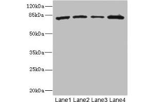 Western blot All lanes: ZP2 antibody at 3. (ZP2 anticorps  (AA 651-745))