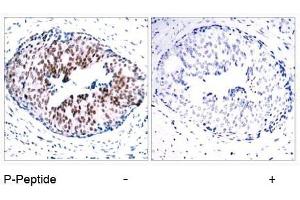 Image no. 1 for anti-Signal Transducer and Activator of Transcription 5A (STAT5A) (pSer780) antibody (ABIN196698) (STAT5A anticorps  (pSer780))