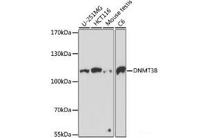 Western blot analysis of extracts of various cell lines using DNMT3B Polyclonal Antibody at dilution of 1:1000. (DNMT3B anticorps)