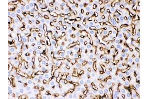 IHC analysis of APOA1 using anti-APOA1 antibody (ABIN3044502).