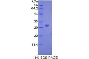 SDS-PAGE of Protein Standard from the Kit (Highly purified E.