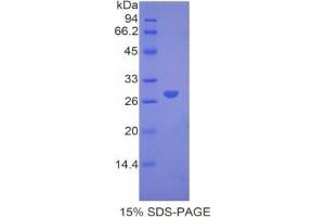 SDS-PAGE of Protein Standard from the Kit (Highly purified E. (alpha 2 Macroglobulin Kit ELISA)