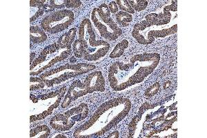 IHC analysis of TRMT6 using anti-TRMT6 antibody (ABIN7602138). (TRMT6 anticorps  (AA 6-489))