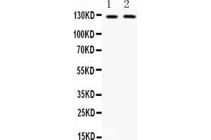 Western blot analysis of CD11b expression in mouse brain extract ( Lane 1) and HEPA whole cell lysates ( Lane 1). (CD11b anticorps  (AA 260-360))