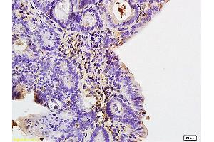 Formalin-fixed and paraffin embedded rat liver labeled with Anti COLEC10(LIVER) Polyclonal Antibody, Unconjugated (ABIN872637) at 1:200 followed by conjugation to the secondary antibody and DAB staining