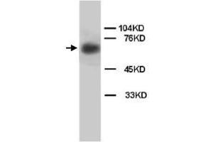 Western Blot analysis of LMNB1 expression from rat brain tissue lyate with LMNB1 polyclonal antibody . (Lamin B1 anticorps  (C-Term))
