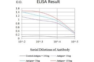 Black line: Control Antigen (100 ng),Purple line: Antigen (10 ng), Blue line: Antigen (50 ng), Red line:Antigen (100 ng)