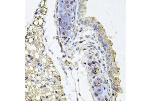 Immunohistochemistry of paraffin-embedded mouse lung using RHOT1 antibody at dilution of 1:100 (x40 lens).