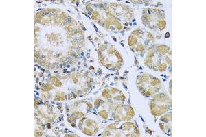 Immunohistochemistry of paraffin-embedded human stomach using PMPCB antibody (ABIN5972414) at dilution of 1/100 (40x lens). (PMPCB anticorps)