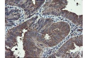 Image no. 5 for anti-TSC22 Domain Family, Member 1 (TSC22D1) antibody (ABIN1501535) (TSC22D1 anticorps)