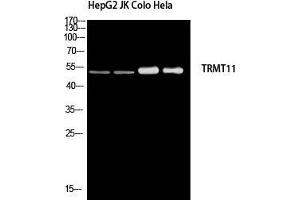Western Blot (WB) analysis of HepG2 JK Colo HeLa using TRMT11 antibody. (Trmt11 anticorps)