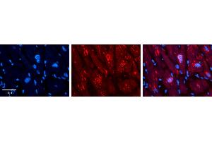 Rabbit Anti-MLX Antibody   Formalin Fixed Paraffin Embedded Tissue: Human heart Tissue Observed Staining: Cytoplasmic, nucleus Primary Antibody Concentration: N/A Other Working Concentrations: 1:600 Secondary Antibody: Donkey anti-Rabbit-Cy3 Secondary Antibody Concentration: 1:200 Magnification: 20X Exposure Time: 0. (MLX anticorps  (C-Term))