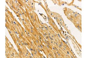 ABIN6258718 and ABIN6274421 at 1/100 staining Rat heart tissue by IHC-P. (TUSC5 anticorps  (N-Term))
