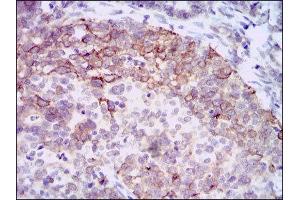 Immunohistochemistry (IHC) image for anti-Hyaluronan Synthase 3 (HAS3) antibody (ABIN1845757) (HAS3 anticorps)
