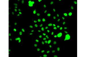 Immunofluorescence analysis of MCF7 cell using CEBPG antibody. (CEBPG anticorps)