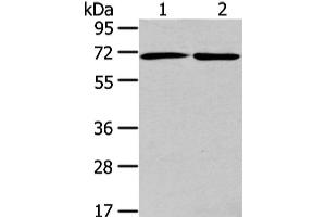 Western Blot analysis of A431 and hela cell using ARFGAP2 Polyclonal Antibody at dilution of 1/200 (arfgap2 anticorps)