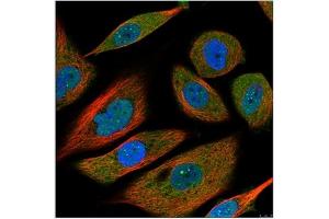 Image no. 1 for anti-Interleukin 6 (IL6) antibody (ABIN181728)