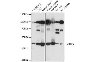 Western blot analysis of extracts of various cell lines, using ZBTB6 antibody. (ZBTB6 anticorps)
