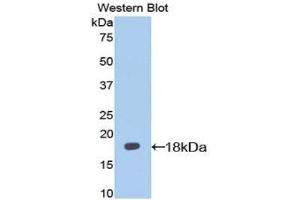Western Blotting (WB) image for anti-Interleukin 13 Receptor, alpha 1 (IL13RA1) (AA 28-171) antibody (ABIN1174862) (IL13 Receptor alpha 1 anticorps  (AA 28-171))