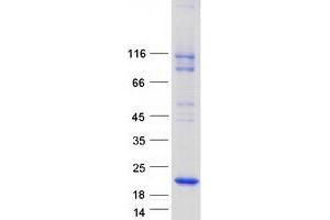 Validation with Western Blot