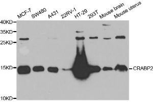 Western blot analysis of extracts of various cell lines, using CRABP2 antibody (ABIN5973604) at 1/1000 dilution. (CRABP2 anticorps)