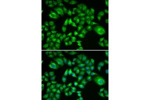 Immunofluorescence analysis of A549 cells using H6PD antibody. (Glucose-6-Phosphate Dehydrogenase anticorps)