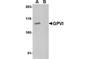 Western Blotting (WB) image for anti-Glycoprotein VI (Platelet) (GP6) (C-Term) antibody (ABIN1030419) (GP6 anticorps  (C-Term))