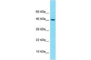 Western Blotting (WB) image for anti-Heterogeneous Nuclear Ribonucleoprotein U-Like 1 (HNRNPUL1) (N-Term) antibody (ABIN2791239) (HNRNPUL1 anticorps  (N-Term))