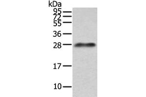 Gel: 12 % SDS-PAGE, Lysate: 40 μg, Lane: Human plasma solution, Primary antibody: ABIN7191260(Lambda Light chain Antibody) at dilution 1/200 dilution, Secondary antibody: Goat anti rabbit IgG at 1/8000 dilution, Exposure time: 10 seconds (IGLV1-51 anticorps)