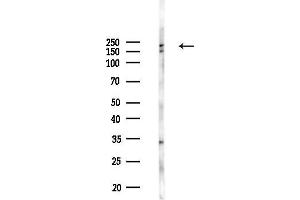 Western blot analysis of lysates from B16F10-LUC cells(UV,30 min treatment), using Phospho-53BP1 (Ser25/Ser29) Antibody at 1/1000 dilution.