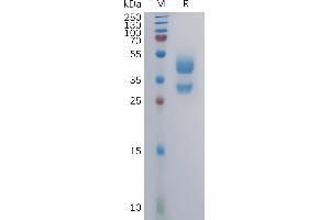 Human C Protein, mFc Tag on SDS-PAGE under reducing condition.