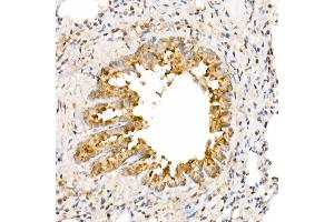Immunohistochemistry of paraffin-embedded rat lung using  Rabbit pAb (ABIN7265581) at dilution of 1:350 (40x lens).