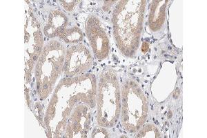 ABIN6267298 at 1/200 staining human kidney tissue sections by IHC-P. (APP anticorps  (pThr668))