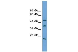 WB Suggested Anti-DUSP5 Antibody Titration: 0. (DUSP5 anticorps  (Middle Region))
