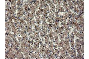 Immunohistochemical staining of paraffin-embedded Human liver tissue using anti-CHN1 mouse monoclonal antibody. (CHN1 anticorps)