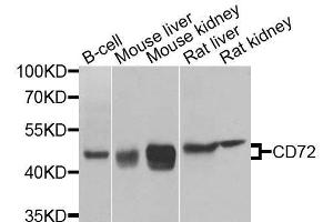 Western blot analysis of extracts of various cell lines, using CD72 antibody. (CD72 anticorps  (AA 120-359))