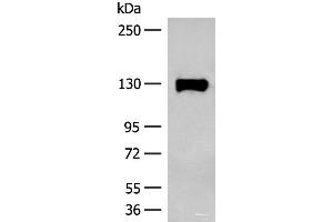 Western blot analysis of Human prostate tissue lysate using SENP6 Polyclonal Antibody at dilution of 1:200 (SENP6 anticorps)
