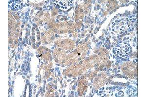 Image no. 1 for anti-Sep (O-phosphoserine) tRNA:Sec (Selenocysteine) tRNA Synthase (SEPSECS) (AA 61-110) antibody (ABIN6736318)