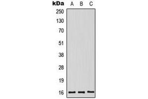 Western blot analysis of Midkine expression in HeLa (A), HepG2 (B), mouse kidney (C) whole cell lysates. (Midkine anticorps  (Center))