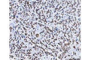 IHC analysis of HnRNP H/HNRNPH1 using anti-HnRNP H/HNRNPH1 antibody (ABIN4886623). (HNRNPH1 anticorps  (N-Term))