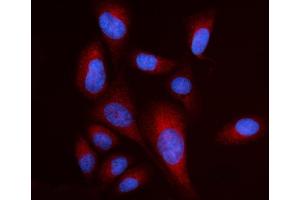 IF analysis of RPL17 using anti-RPL17 antibody (ABIN7601639).
