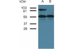 Western blottin analysis of CD54 expression in TNF-alpha activated (A) and nonactivated (B) HUVEC cells by antibody MEM-111. (ICAM1 anticorps)