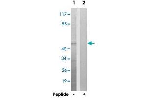 Western blot analysis of extracts from HepG2 cells, using UBXN11 polyclonal antibody . (UBXN11 anticorps)