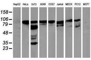 Image no. 6 for anti-Breast Cancer Anti-Estrogen Resistance 1 (BCAR1) antibody (ABIN1496833)