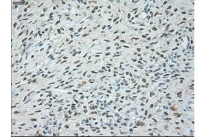 Immunohistochemical staining of paraffin-embedded colon tissue using anti-USP13mouse monoclonal antibody. (USP13 anticorps)