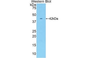 Western blot analysis of the recombinant protein. (CKM anticorps  (AA 11-367))