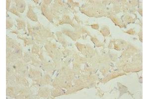 Immunohistochemistry of paraffin-embedded human heart tissue using ABIN7163185 at dilution of 1:100 (PIP5K1A anticorps  (AA 293-562))
