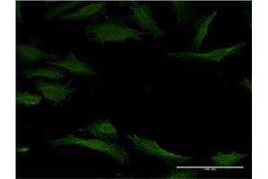 Immunofluorescence of monoclonal antibody to CYP1A2 on HeLa cell.